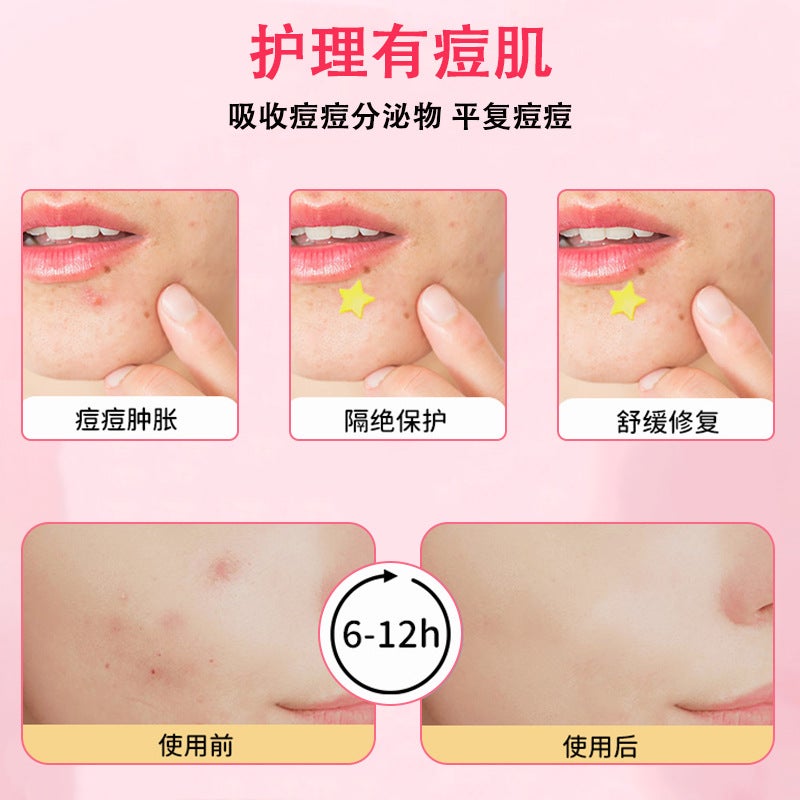 Matte Double Eyelid Patch Artifact, Traceless Invisible Natural Swollen Eye Bubble Beauty Patch, Waterproof And Sweat-Proof Single Eyelid Patch - Image 5